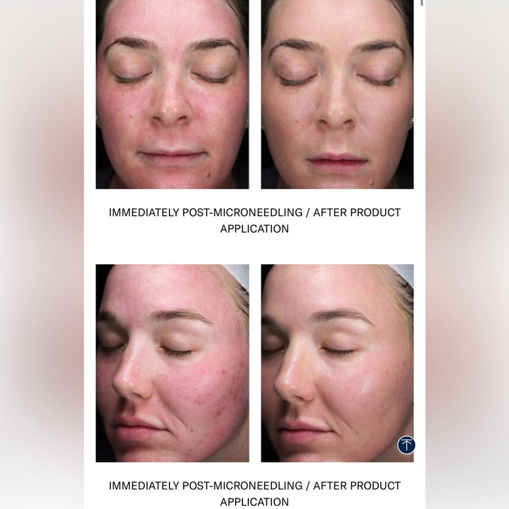 NEW Bundle SKINBETTER SCIENCE SUNBETTER TONE SMART SPF 75 Sunscreen Lotion - Picture 5 of 5